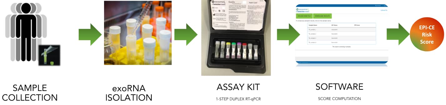 ExoDx™ Prostate EPI-CE IVD Workflow