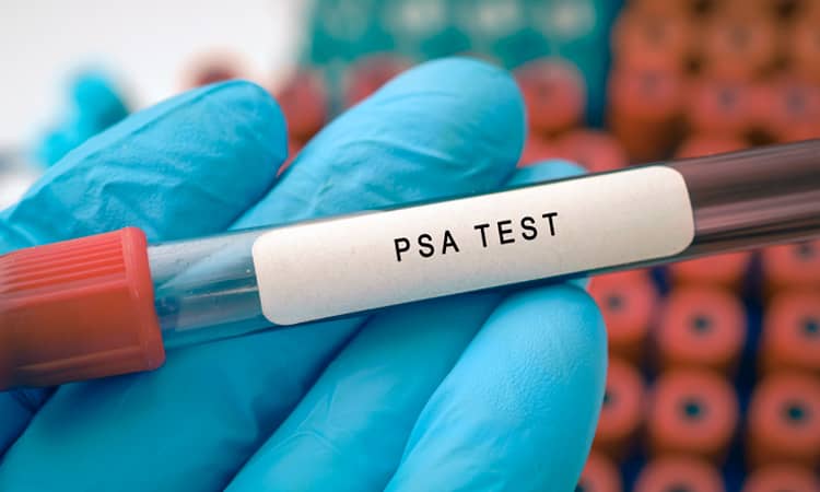 psa test vial